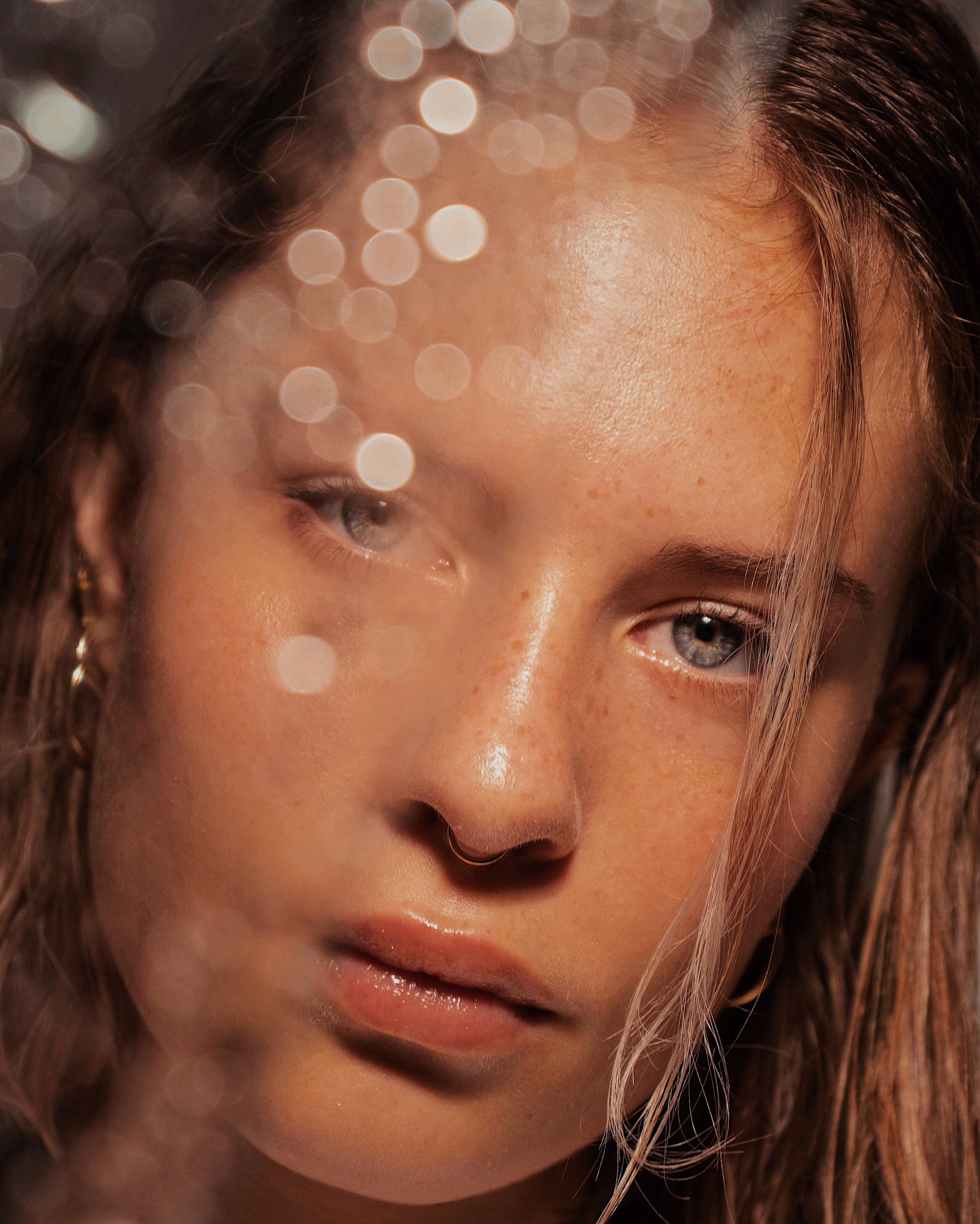 MULTILEVEL SKIN RESURFACING USING DEFINISSE .