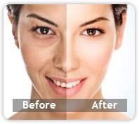 Chest wrinkles & Discolouration.