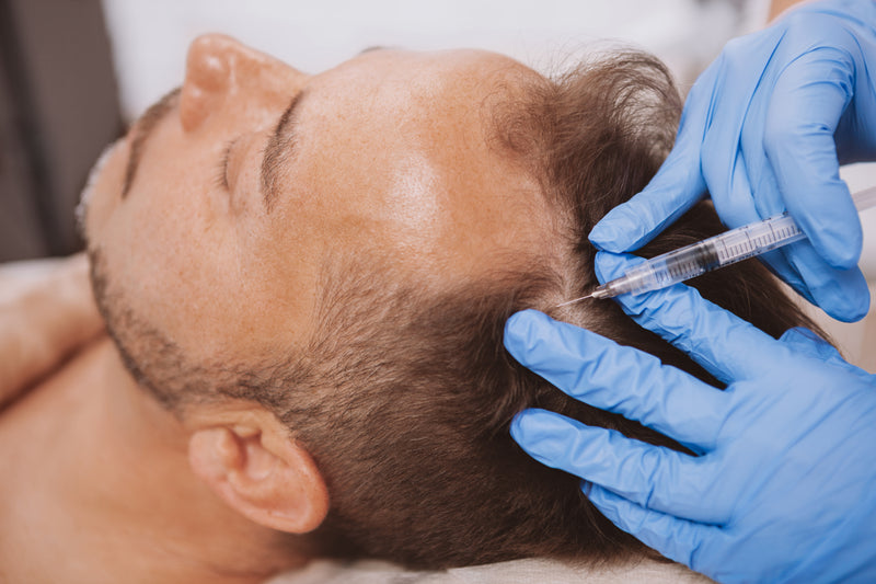 PRP - Platelet Rich Plasma.
