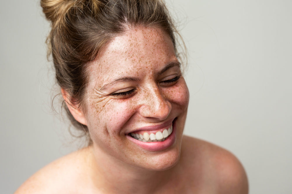 Skin Peels- Chemical Peels