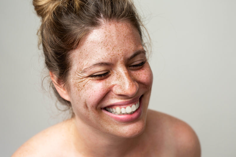 Skin Peels- Chemical Peels
