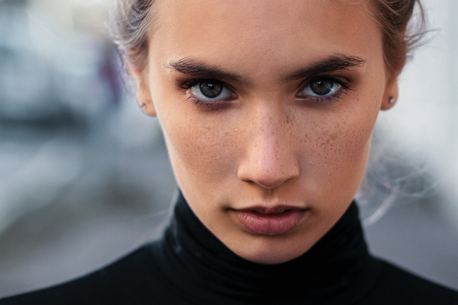 Chemical Peels