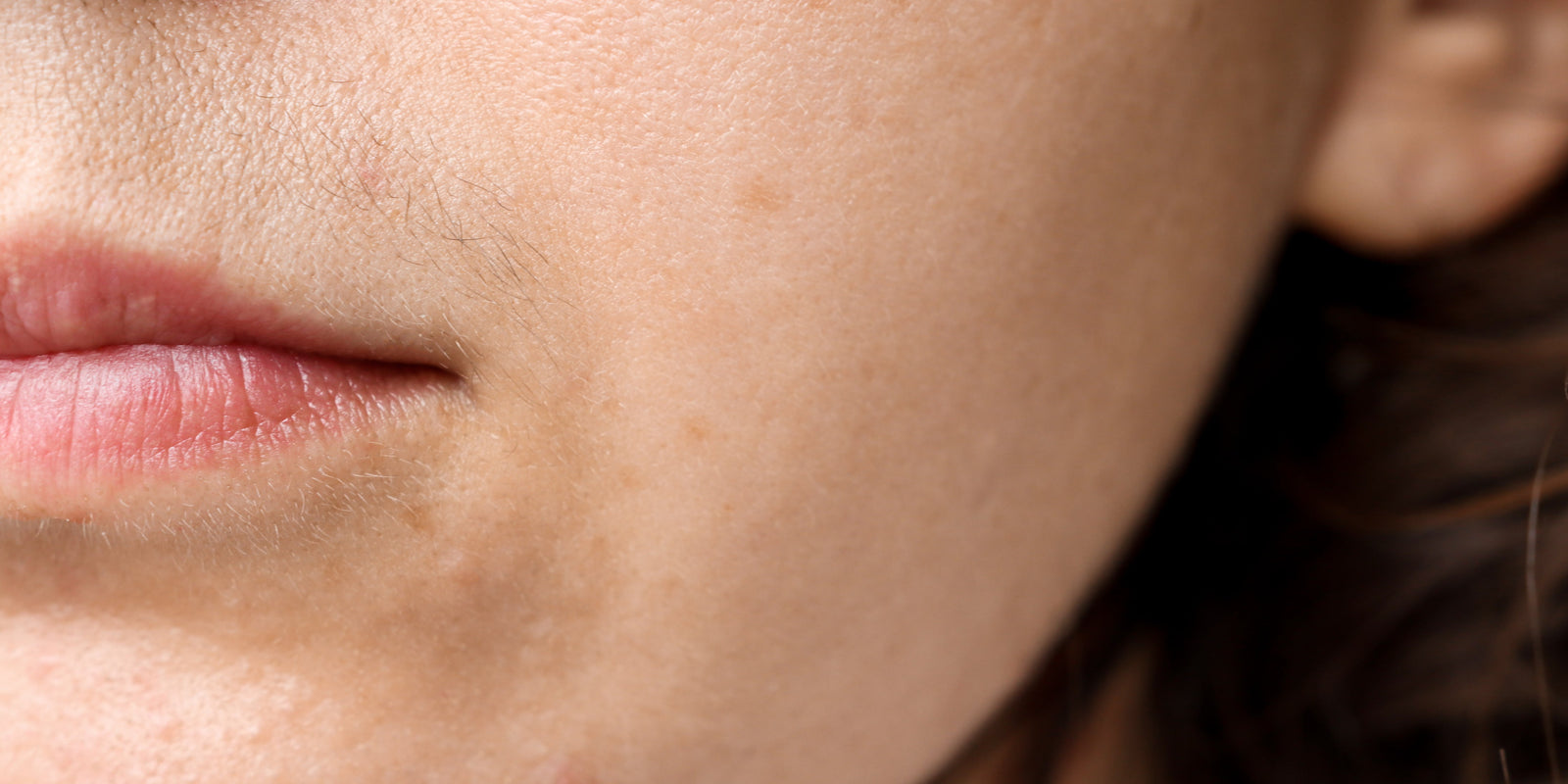 Trans epidermal Water Loss – What is it and How to Stop It
