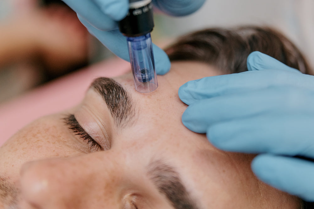 Micro Needling - Taking Advantage of the Body's Natural Healing Response.