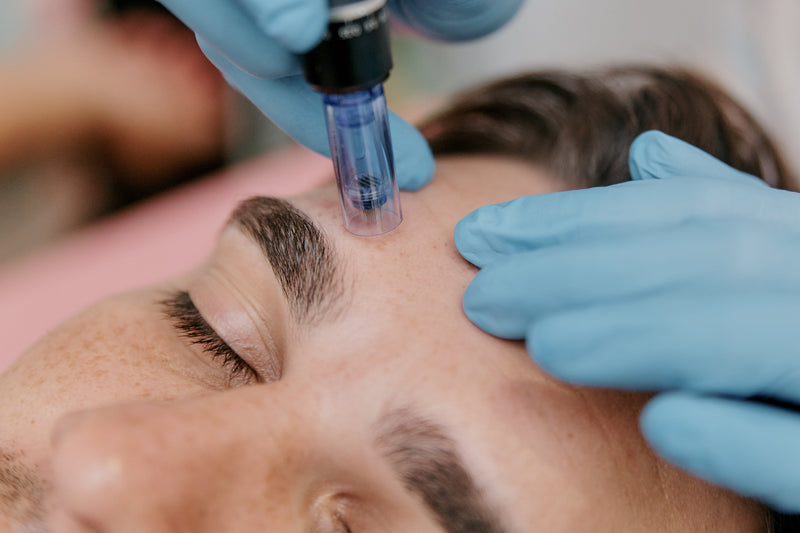 Micro Needling - Taking Advantage of the Body's Natural Healing Response.