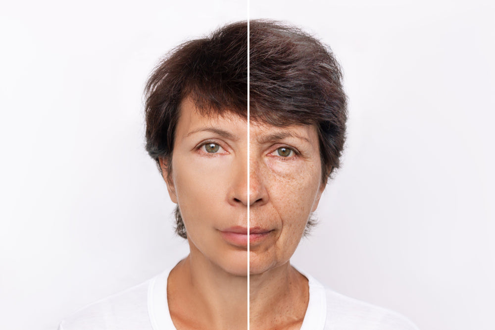 What causes skin to age ?