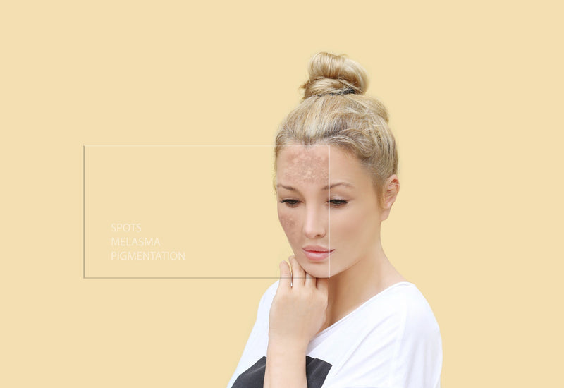 Pigmentation - the story continues.