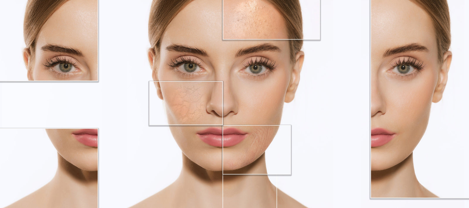 Dehydrated Skin and how to treat it.