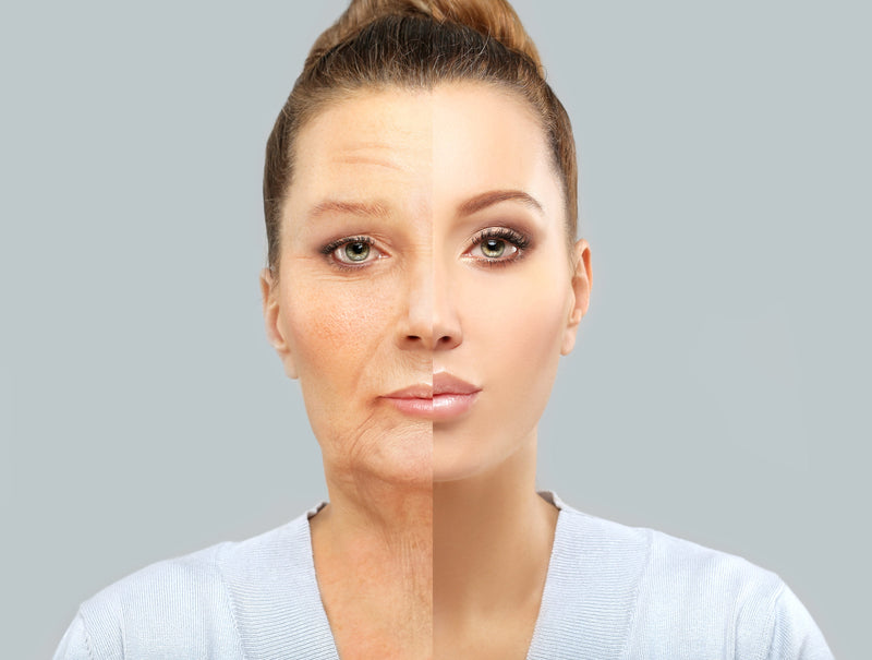 What causes skin ageing?