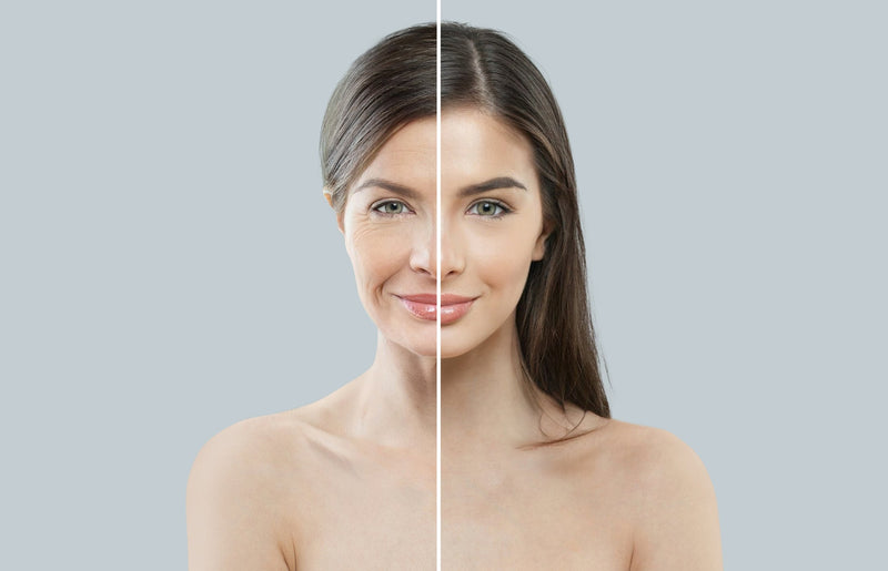 Can Skin Be Retrained? How to Restore Healthier Skin Function Over Time at Woulfe Skin Specialists & Wellness
