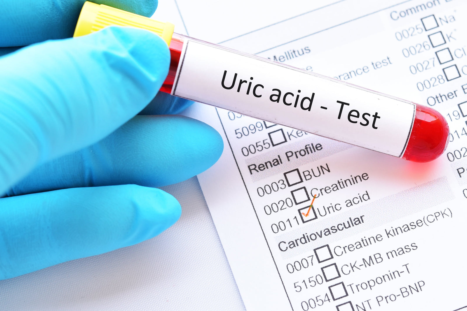Uric Acid.