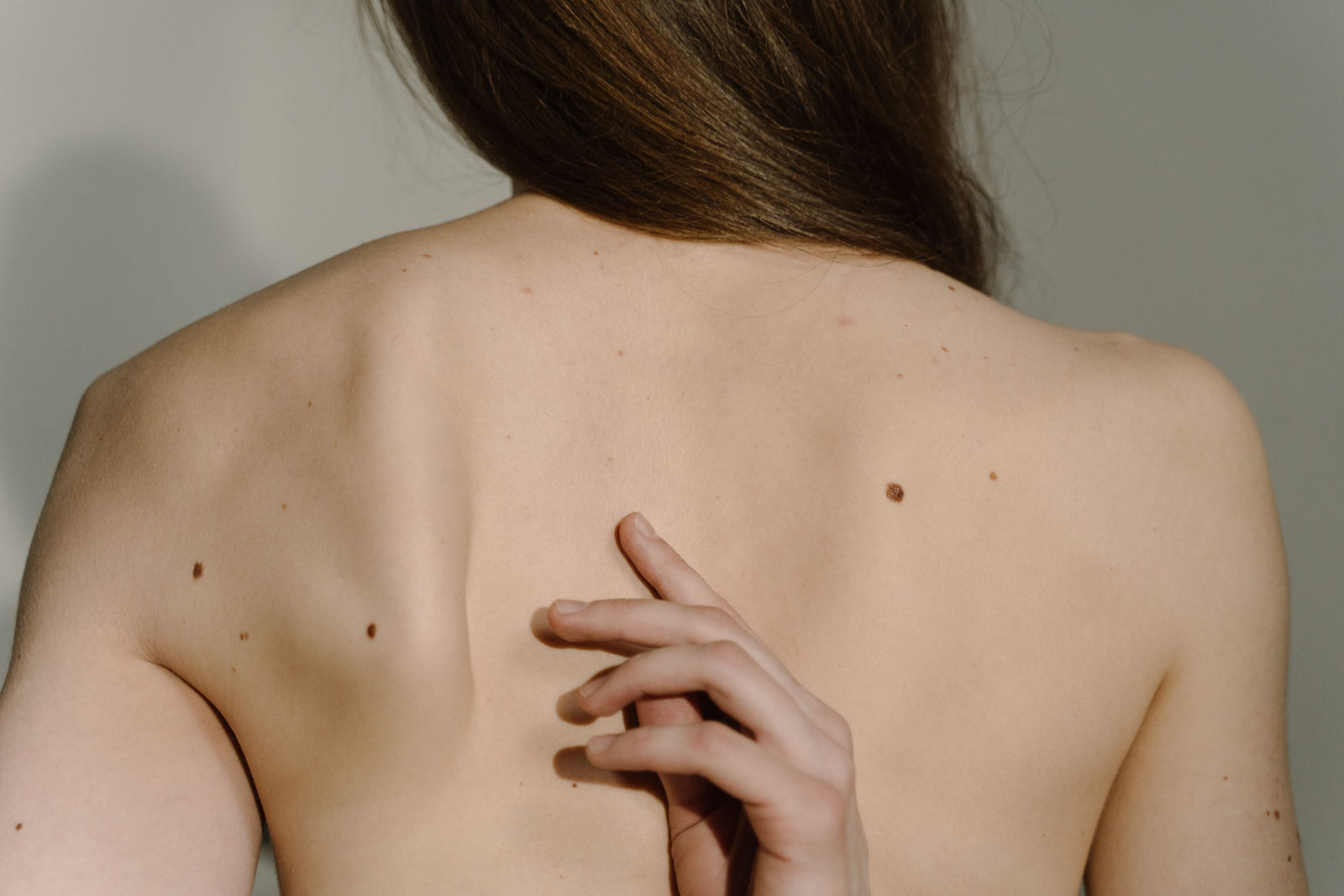 Histamine, Mast Cells & Your Skin