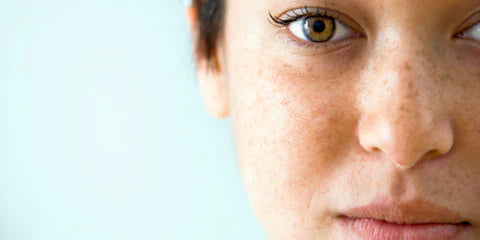 Pigmentation