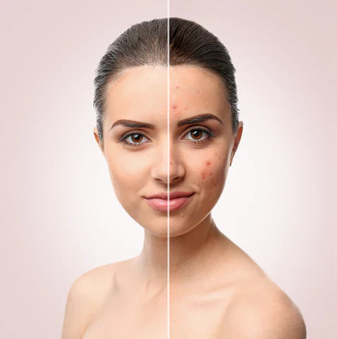 How to take care of your skin to retain a youthful appearance.