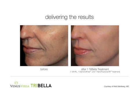 Tribella by Venus Versa