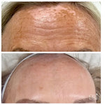 CELLULAR REJUVENATION FACIAL CELLSTORY LIQUID MICRONEEDLING –no needles or equipment.