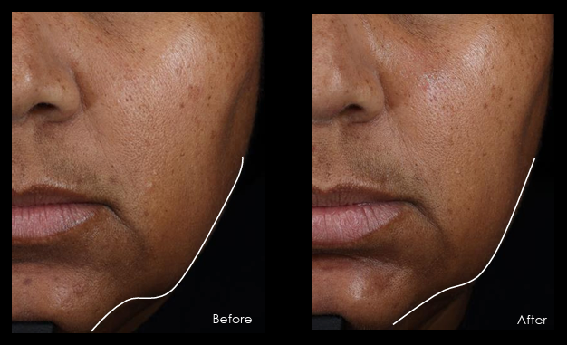 SkinCeuticals A.G.E Interrupter Ultra Serum