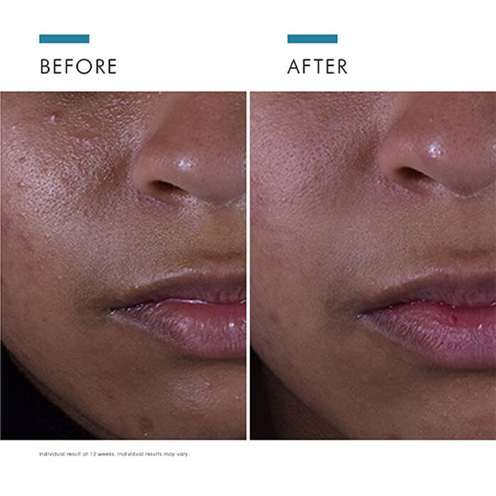 SkinCeuticals Double Defence Silymarin CF Kit.Free Oil Shield UV Defence SPF 50 worth €56